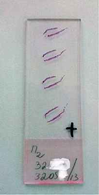 Общий вид гистологического препарата