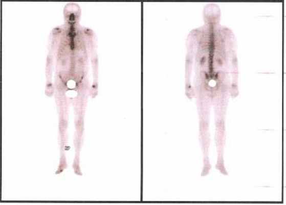 Сканограмма костей скелета