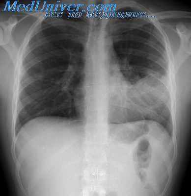 рентгеновское излучение