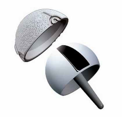 Поверхностный эндопротез тазобедренного сустава (Birmingham или McMinn)