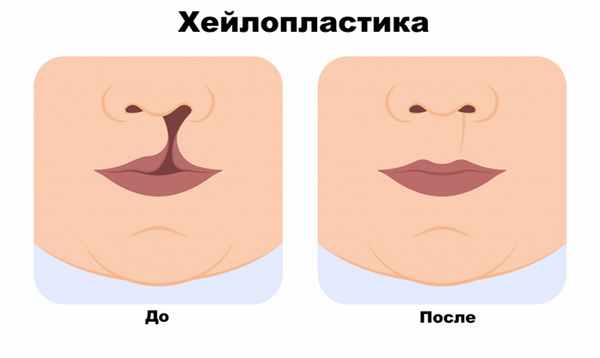 После операции.jpg