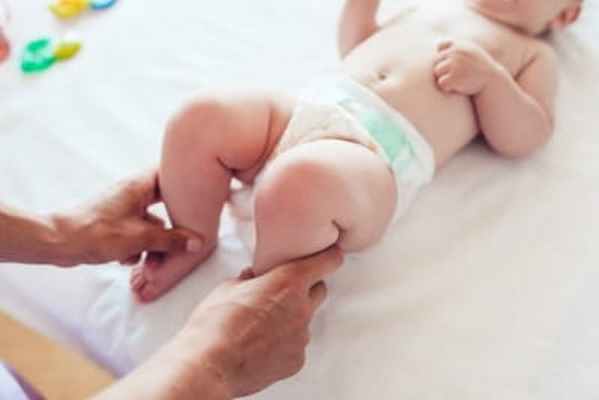 Диагностика рахита