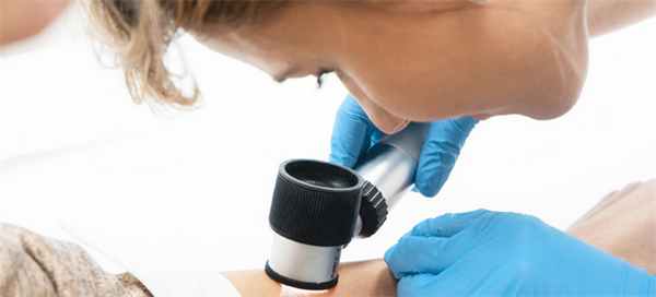 Лечение отрубевидного лишая