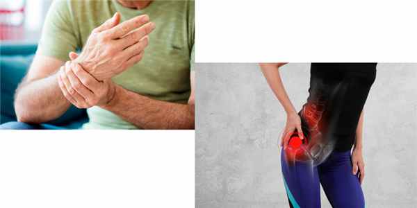 Симптомы реактивного артрита