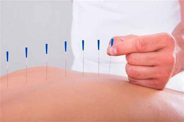 Иглорефлексотерапия в СПб