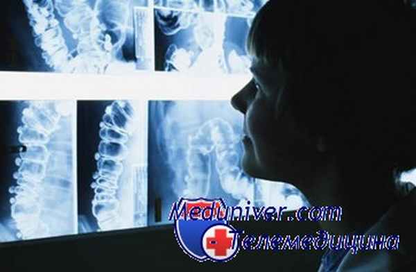 Релапаротомия и лапаростомия при инфекционных осложнениях