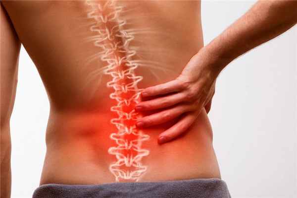 Симптомы кисты позвоночника