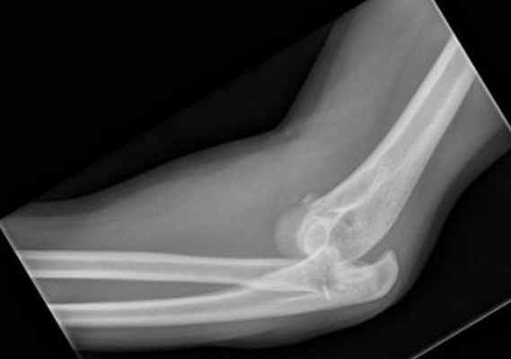 страшная триада-обр