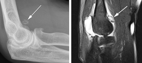 loktevaya-sustavnaya-mysh
