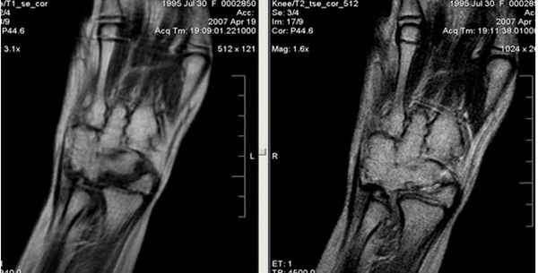 МРТ кисти: когда назначается?
