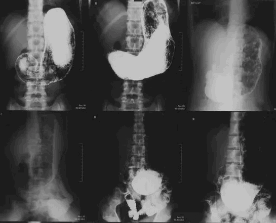 Рентгеноскопия