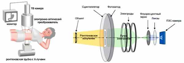 Рентгеновские исследования