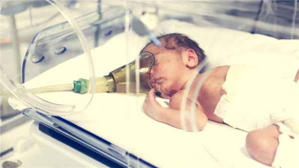 Респираторный дистресс-синдром новорожденных