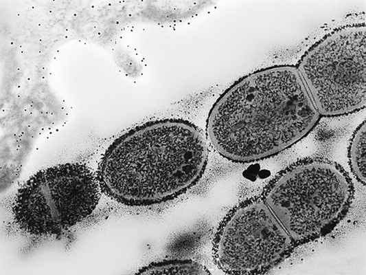 стрептококк