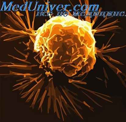 химиотерапия