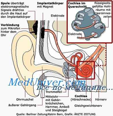 отогенный менингит