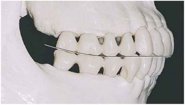 Фото кривой Шпее