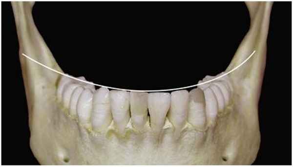 Фото линии Уилсона