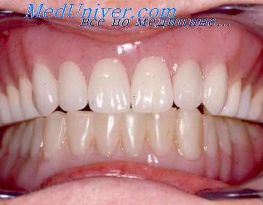 аномалии прикуса