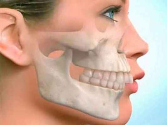 Дистальный прикус