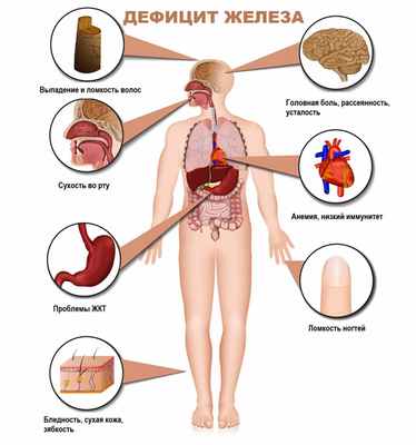 Дефицит железа.jpg