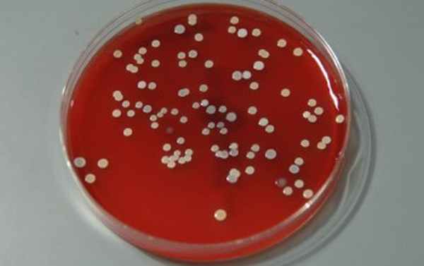 Санитарно микробиологическое исследование почвы