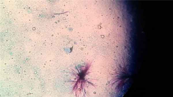 Дизентерийная амеба паразитирует только в человеке.