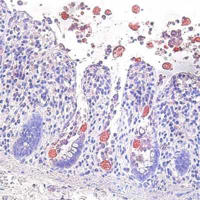 Дизентерийная амёба (Entamoeba histolytica), простейшее из отряда амёб.