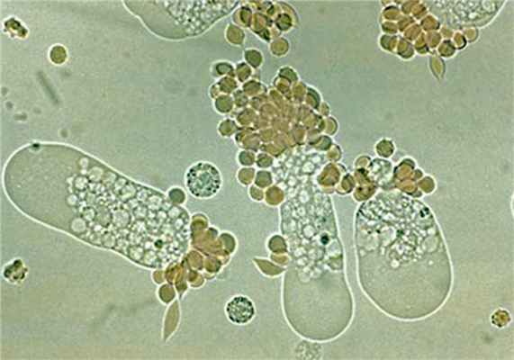 Как и у любого паразита, у дизентерийной амебы есть 2 формы жизни.