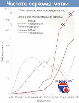 Частота саркомы матки