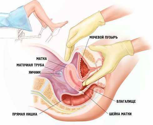 Гинекологический осмотр
