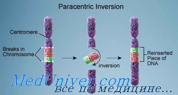 парацентрическая инверсия хромосом