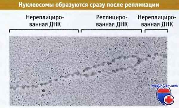 Нуклеосомы