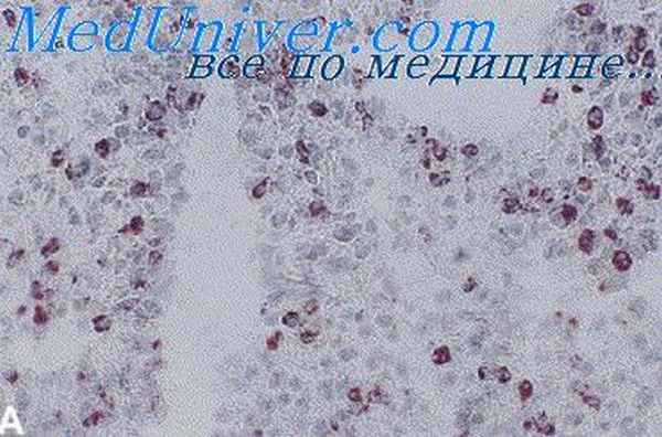 сенсебилизация организма