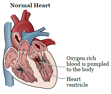 Рисунок 1. Здоровое сердце