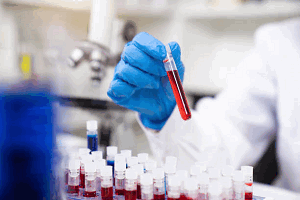 Анализ крови на серотонин