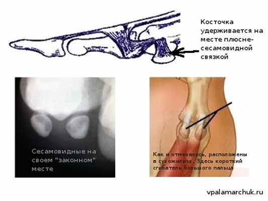 почему болит большой палец
