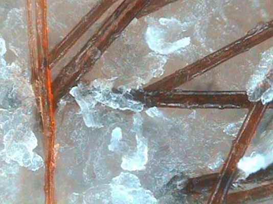 Крупнопластинчатое шелушение.jpg