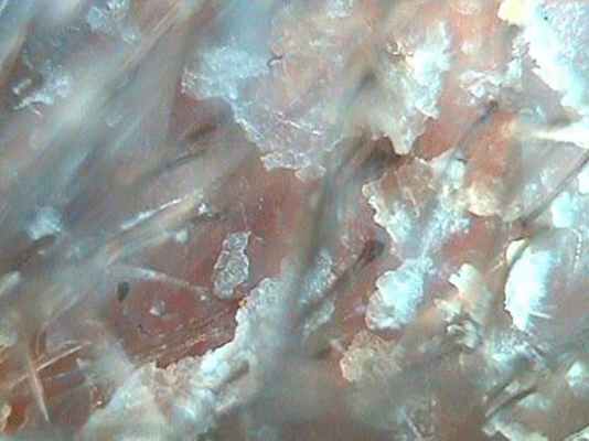 Мелкопластинчатое шелушение.jpg