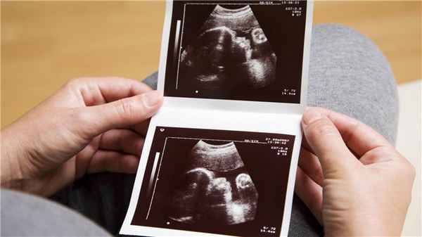 УЗИ и патологии плода