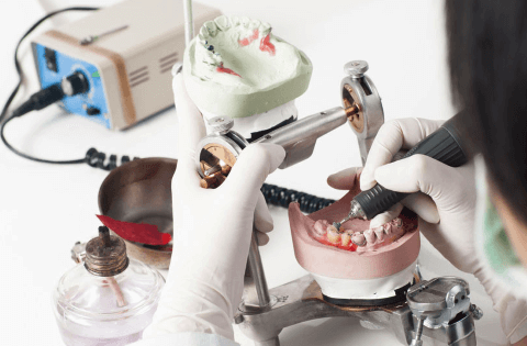 шинирующие бюгельные протезы фото