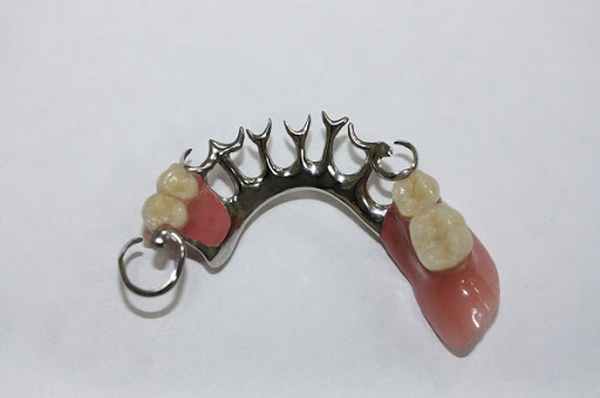 shiniruyushchij-byugelnyj-protez