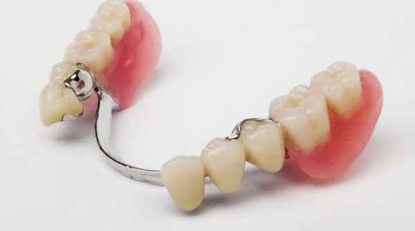 Фото бюгельный протез