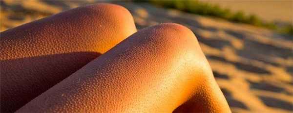 Фолликулярный гиперкератоз