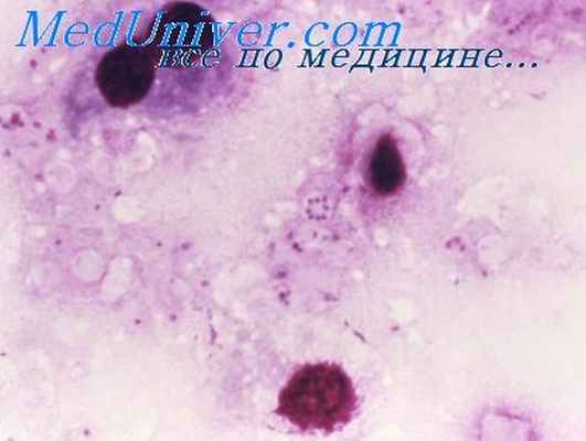 празиквантел