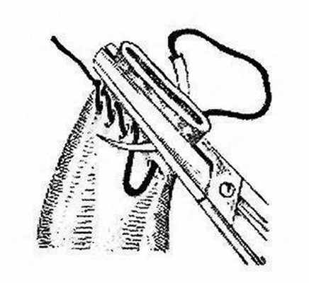 Непрерывно-возвратный кишечный шов