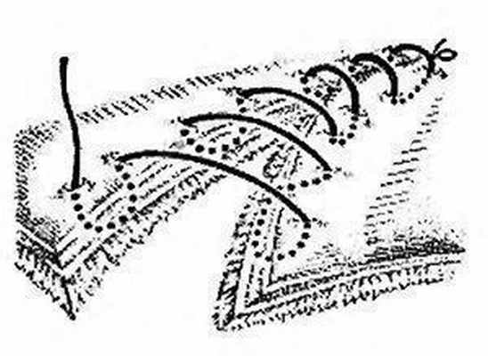 Непрерывный кишечный шов Кушинга