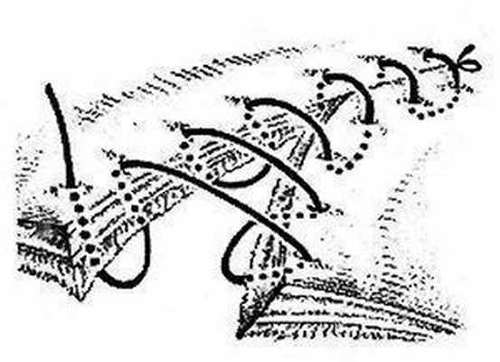 Непрерывный кишечный шов Коннеля