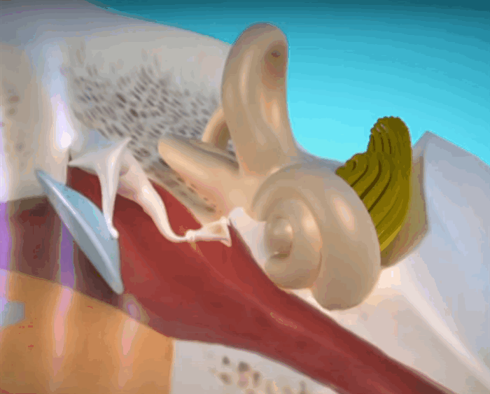 Лечение невриномы слухового нерва в Германии