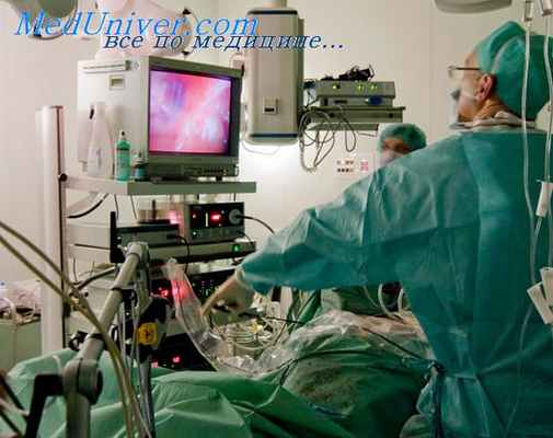 симпатэктомия